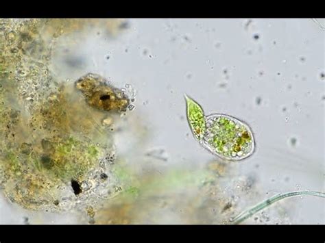  Urotrichia: A Tiny Ciliate That Dances With Microscopic Algae!